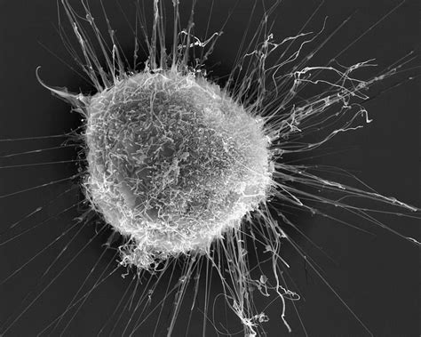 Electron Microscope Cancer Cells Micropedia