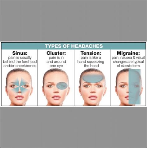 4 Most Common Headache Types Sydney Headache And Migraine Clinic