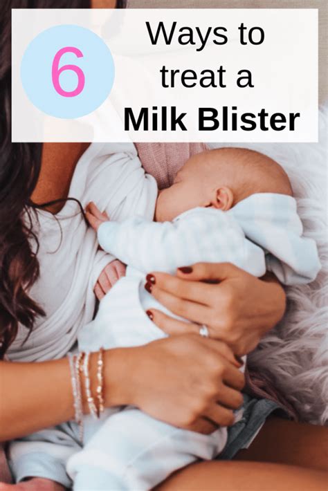 6 Tips To Get Rid Of A Milk Blister Bleb Fit Mommy In Heels
