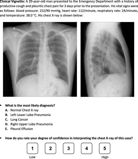 A Question From The Survey On A Left Lower Lobe Pneumonia Case