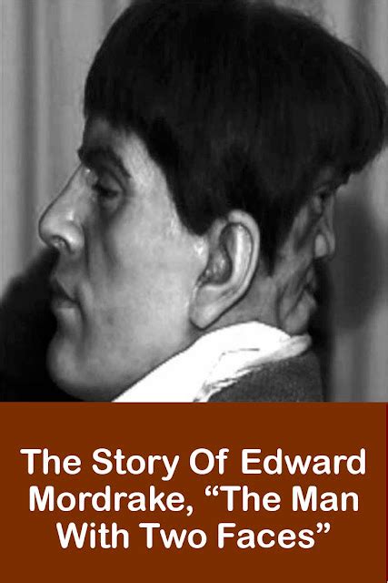 The Story Of Edward Mordrake “the Man With Two Faces”