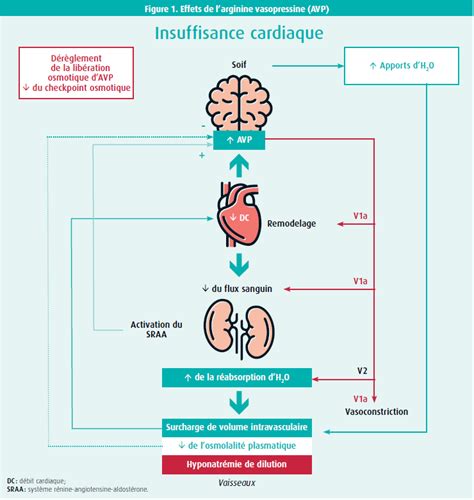 Lhyponatrémie En Cas Dinsuffisance Cardiaque De Nouvelles Solutions