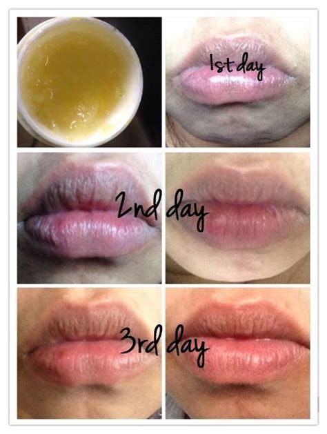 Coconut oil for chapped lips: DIY To Lighten Dark Lips here's the recipe of my DIY Lip ...