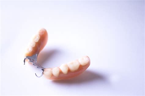 Woodland Hills Dentist Looks At How We Support Partial Dentures