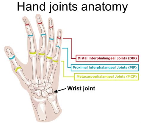 Hand Dislocation Causes Symptoms Diagnosis Treatment And Prognosis
