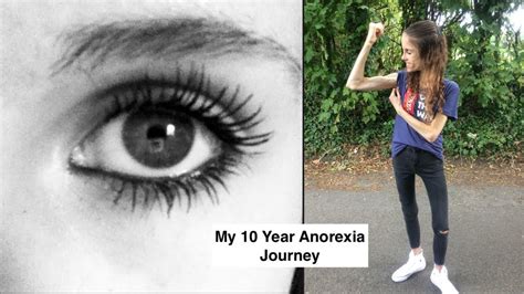 My 10 Year Anorexia Journey Finding My Way Through Fitness