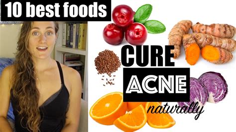 Top 10 Best Foods To Cure Acne Naturally The Acne Series Youtube