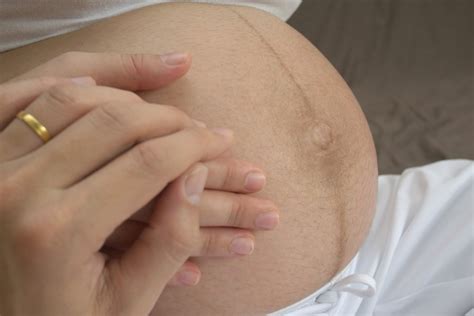 It may have been there all along and you only noticed it. Pregnancy Line - Linea Nigra