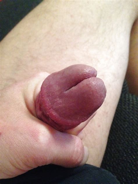 Penis With Large Glans Ncee