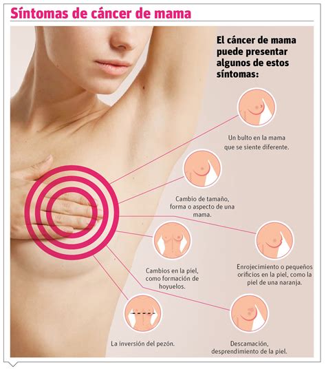 Öntőforma Esemény Ellenálló centro de diagnostico de las afecciones mamarias Dokumentum Zár Infect
