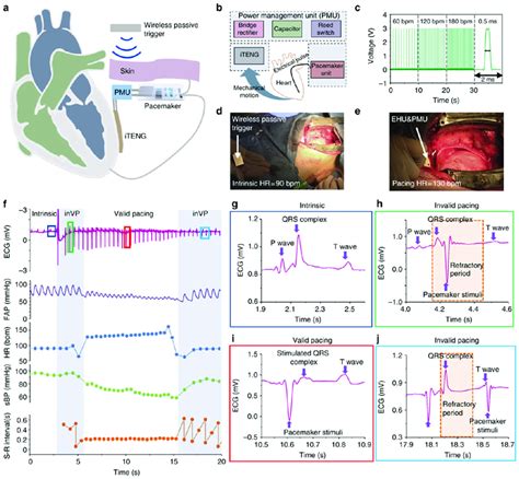 Performance Of The Symbiotic Cardiac Pacemaker Designed By Ouyang Et