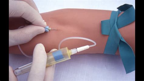 My Personal Np Prep Phlebotomy Hand Position