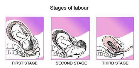 The second stage of labor is marked by complete dilatation of the cervix and increase in frequency of the uterine contractions. All You Need To Know About The Three Stages Of Labor | The ...