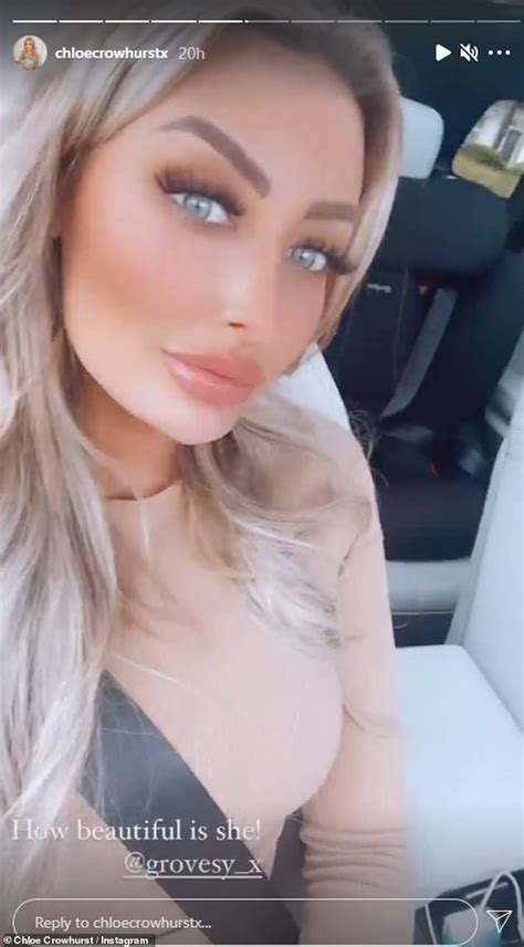 Love Island S Chloe Crowhurst In Hospital After Being In A Serious Car