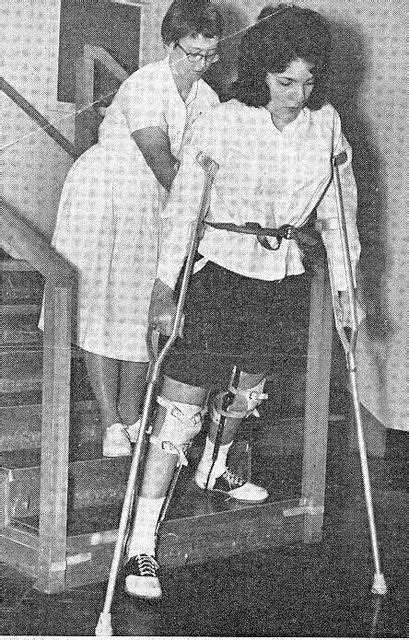 Pin By Dianne Dych On Polio 3 Polio Braces Leg Braces