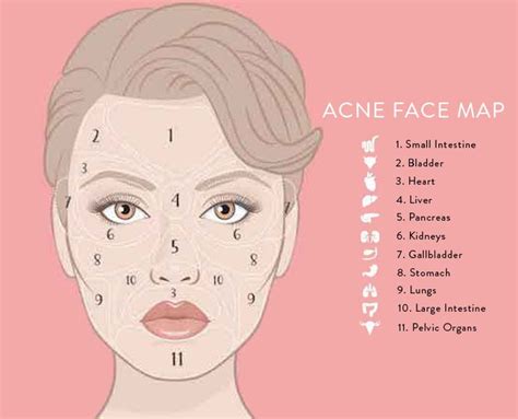 Doterra Acne Skin Tips Skin Care Tips Skin Care Routine Anti Aging