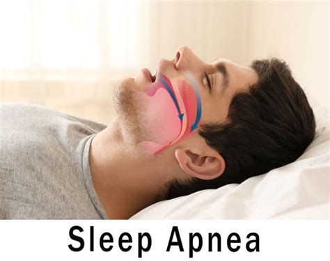 Mattress firm's highly trained sleep experts™ know how. Can the Right Mattress Help with Sleep Apnea? | Asheville ...