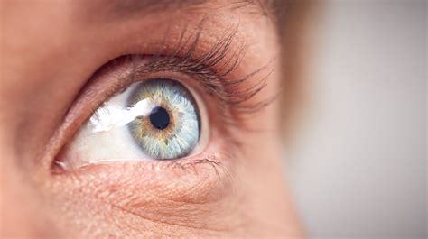 Dealing With A Rare Eye Disease In The Midst Of Covid19