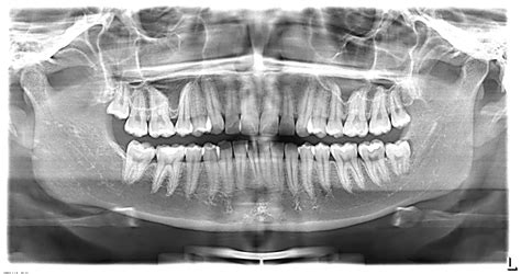RadiografÍas Dentales Medical Dentix Sac