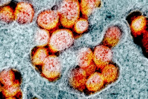 Alpha Coronavirus Variant Evolved To Evade Immune System Uc San Francisco