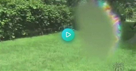 This Is What A Migraine Aura Looks Like  On Imgur