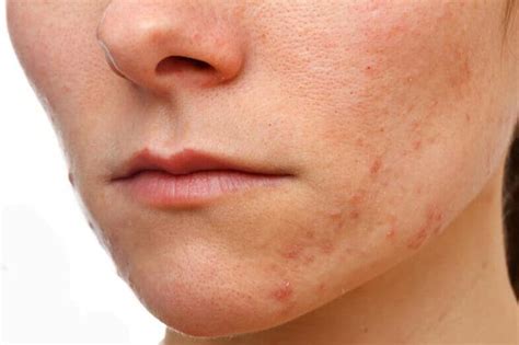 Types Of Skin Problems On Face Top 10 List Skin Care Geeks