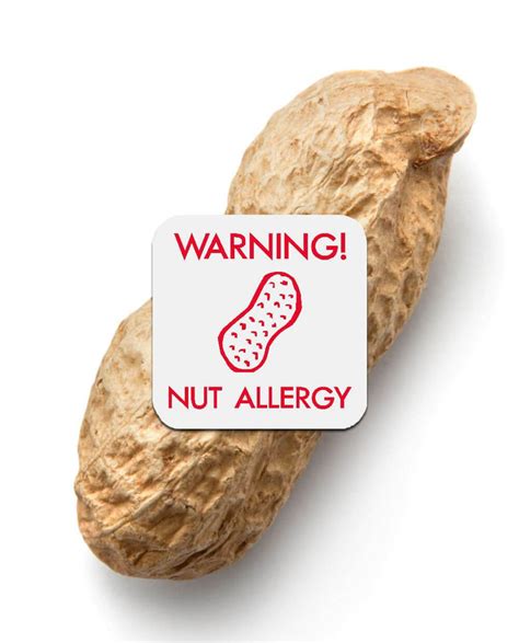 Nut Allergy Stickers My Name Label Nz