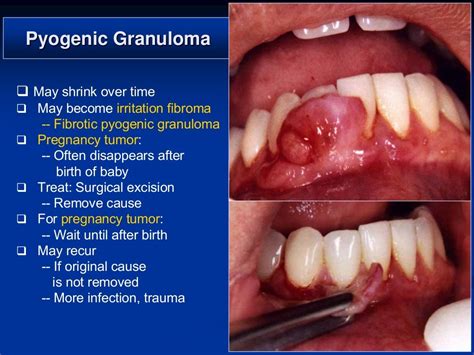 The Different Types Of Oral And Maxillofacial Pathologies Steve Gallik