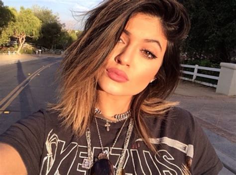 kylie jenner plastic surgery lip injections photos