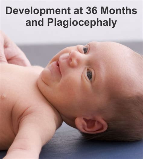 Development And Plagiocephaly Your Therapy Source