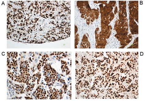 The Prognostic Value Of The Immunohistochemical Expression Of