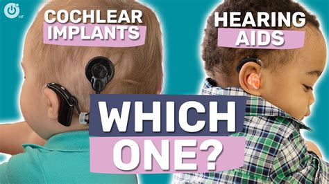 Hearing Aids Vs Cochlear Implants For Babies And Kids Youtube