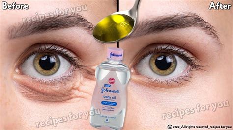 Under Eye Wrinkles Under Eye Puffiness Remove Dark Circles Dark