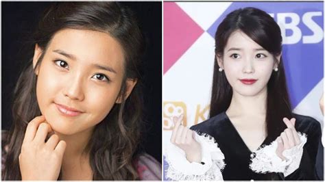 Iu Before And After Plastic Surgery