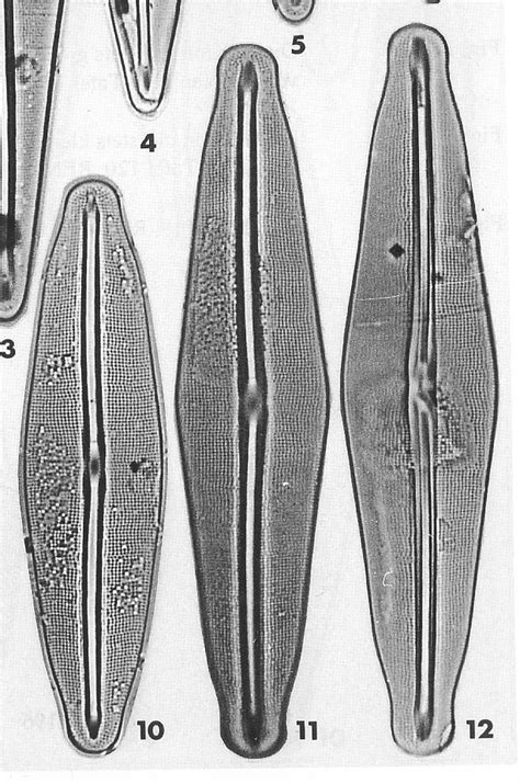 Image Quadrioimages Species Diatoms Of North America