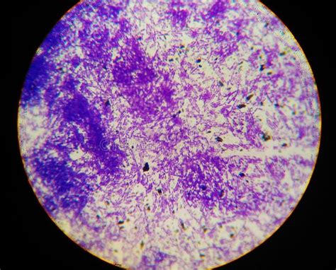Gram Positive Bacilli With Spor Forming Stock Photo Image Of