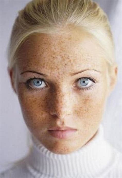 Does Blonde Hair With Freckles Look Unnatural Yahoo Answers Free Download Nude Photo Gallery