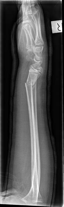 Orthopaedic Clinic Wrist Radiography Wikiradiography
