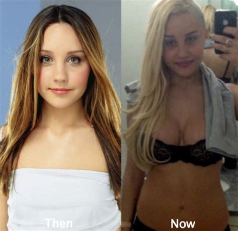 Amanda Bynes Plastic Surgery Before And After Photos
