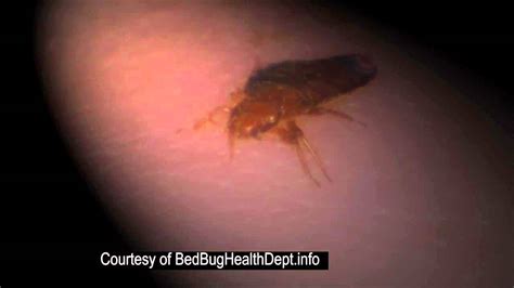 Bed Bug Feeding On Babies And Children Live Video Study Youtube