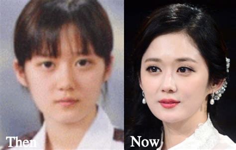 Some of the alleged plastic surgery procedures include an eyelid lift. Jang Nara Plastic Surgery Before and After Photos - Latest ...