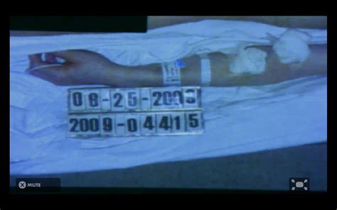 New Michael Jackson Autopsy Photo