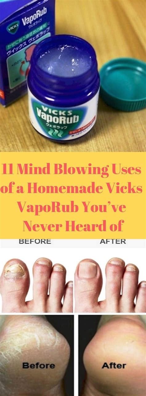 11 Mind Blowing Uses Of A Homemade Vicks Vaporub Youve Never Heard Of