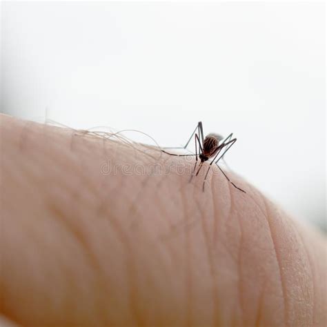 Mosquito Bite Stock Image Image Of Summer Small Epidemic 34982869