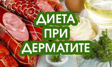 Себорейный дерматит диета питание Питание при дерматите Питание при дерматите Себорейный дерматит диета питание