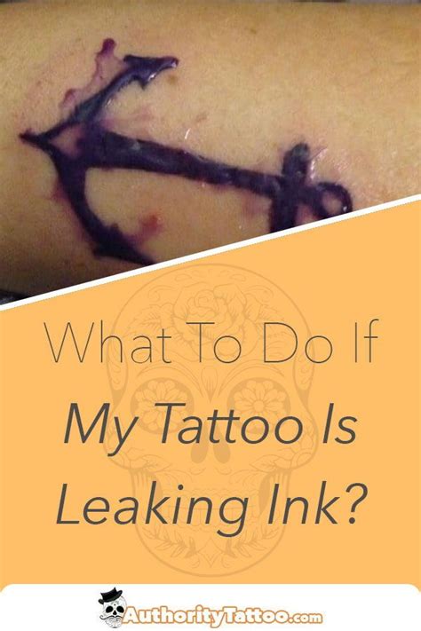 Share 68 Tattoo Leaking Plasma Incdgdbentre