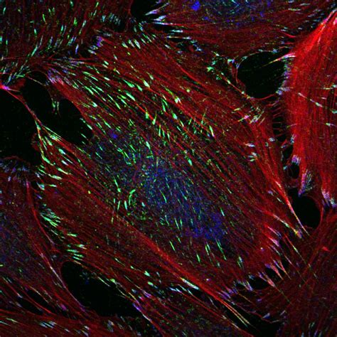 Have students use microscopes to observe the shapes of plant and animal cells. This is what a tumor cell looks like under a microscope ...