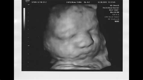 Ultraschall in 3d erlaubt lebensechte bilder von ihrem baby schon während der schwangerschaft. 3D Ultraschall: 22.+ 27. SSW - 1111 Abonnenten Special ...