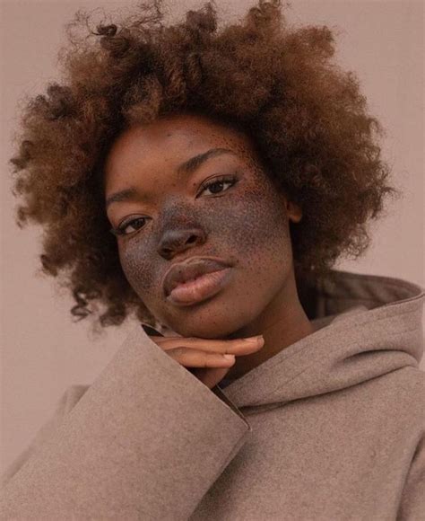 S K I N On Instagram “amazing Freckles Swipe” Black Girl Aesthetic
