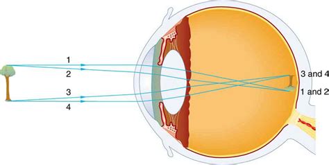 111 Physics Of The Eye And The Lens Equation Douglas College Physics